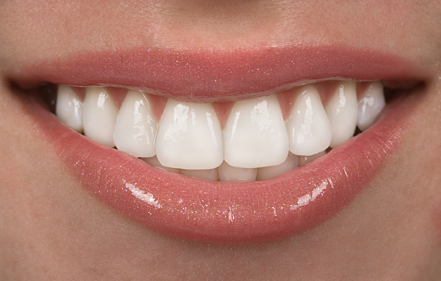 Healthy teen mouth with beautiful white teeth