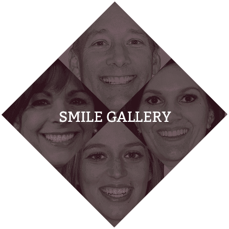 Smile Gallery of Lafayette Louisiana Cosmetic Dentist Dr. Mike Malone