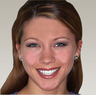 A gorgeous smile created by cosmetic dentist Dr. Mike Malone