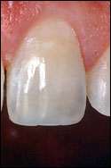 image of a tooth
