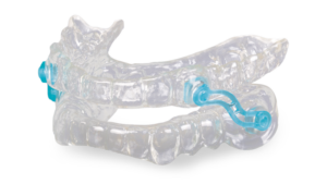 The Silent Nite® is a dental appliance which resembles a mouth guard, and is made up of two rows of clear, plastic impressions of the patient's top and bottom teeth.