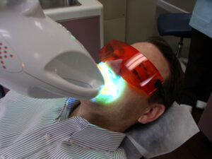 Zoom whitening patient under the light