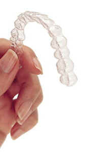 Dental Aligner Appliance