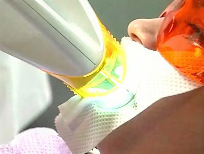 The Zoom light focused on the teeth to activate the whitening gel